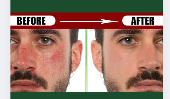 Psorio Amrit Syrup – आयुर्वेदिक त्वचा समाधान - Image 3