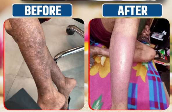 Psorio Amrit Syrup – आयुर्वेदिक त्वचा समाधान - Image 4